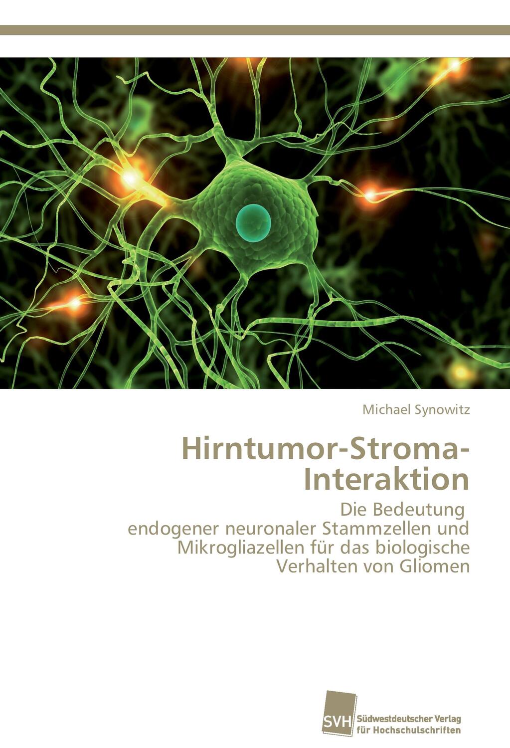 Cover: 9783838134185 | Hirntumor-Stroma-Interaktion | Michael Synowitz | Taschenbuch | 64 S.