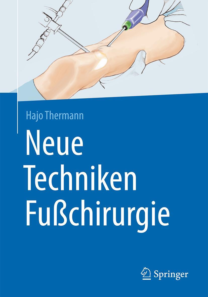 Cover: 9783662527368 | Neue Techniken Fußchirurgie | Hajo Thermann | Buch | xii | Deutsch