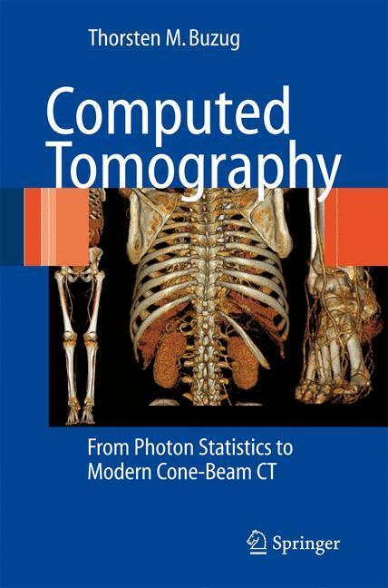 Cover: 9783642072574 | Computed Tomography | From Photon Statistics to Modern Cone-Beam CT