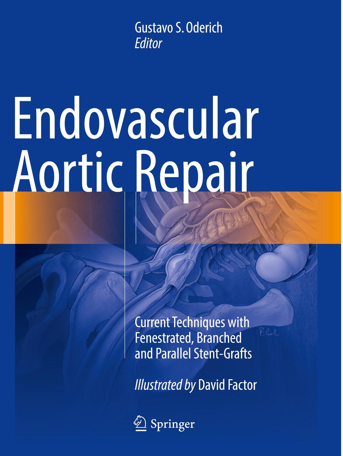 Cover: 9783319792149 | Endovascular Aortic Repair | Gustavo S. Oderich | Taschenbuch | xxvi