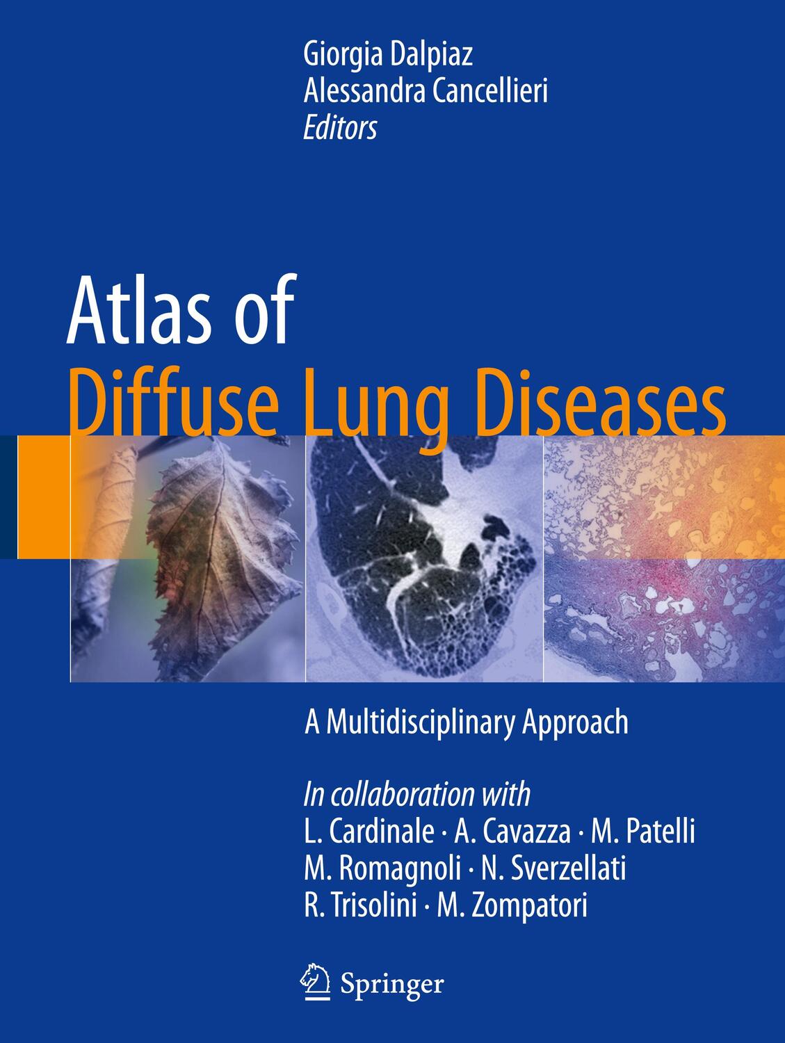 Cover: 9783319427508 | Atlas of Diffuse Lung Diseases | A Multidisciplinary Approach | Buch