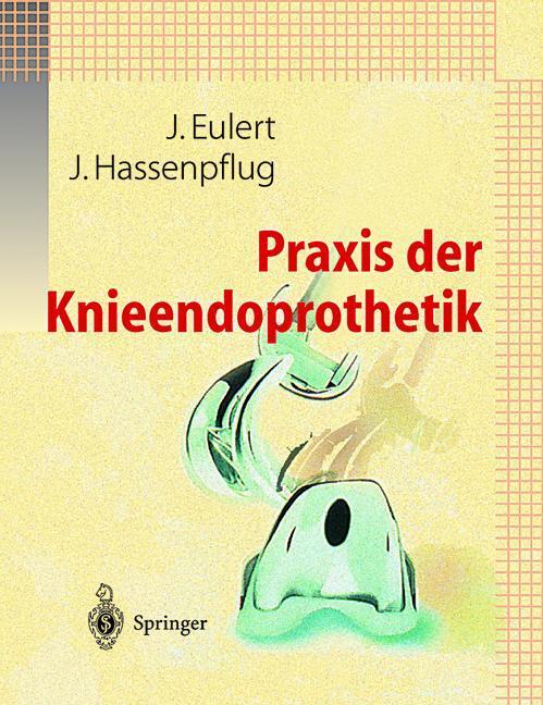 Cover: 9783642640063 | Praxis der Knieendoprothetik | J. Hassenpflug (u. a.) | Taschenbuch